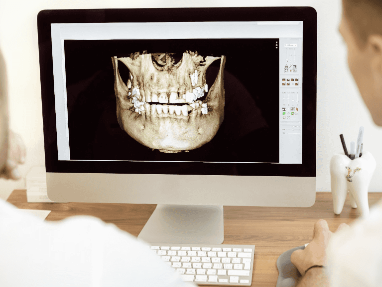 CBCT Cone Beam Technology in Dental in Focus Pimpama