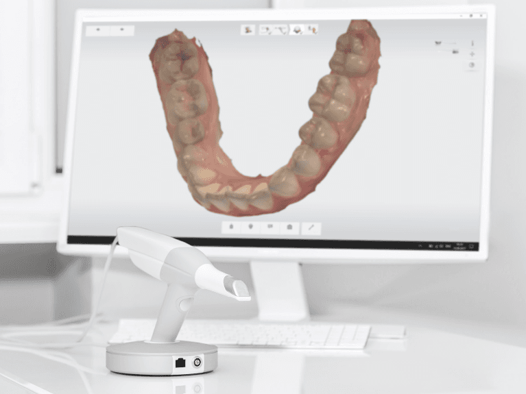 Digital Impressions in Dental in Focus Pimpama
